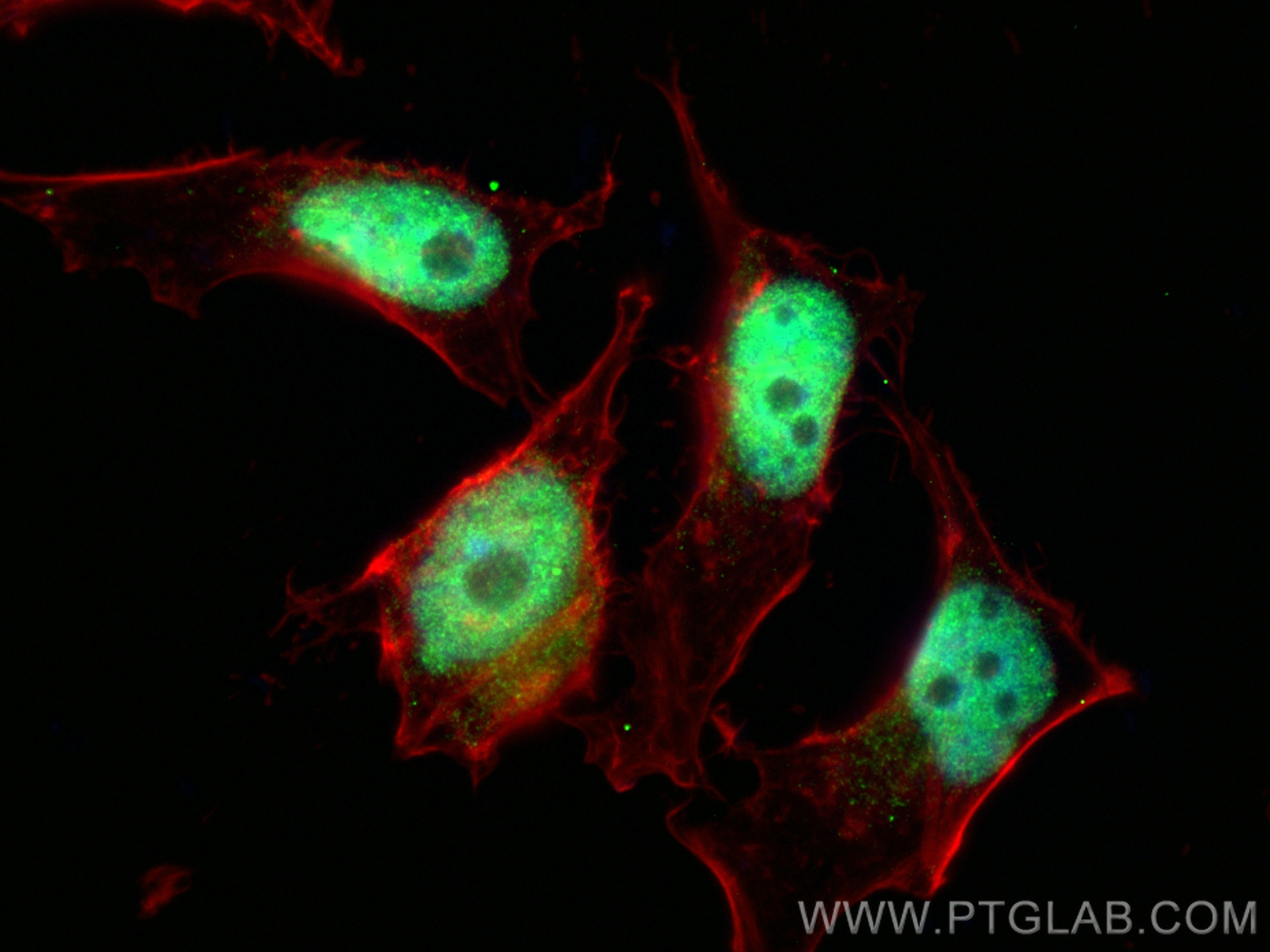 Immunofluorescence (IF) / fluorescent staining of HeLa cells using NFIB Polyclonal antibody (29898-1-AP)