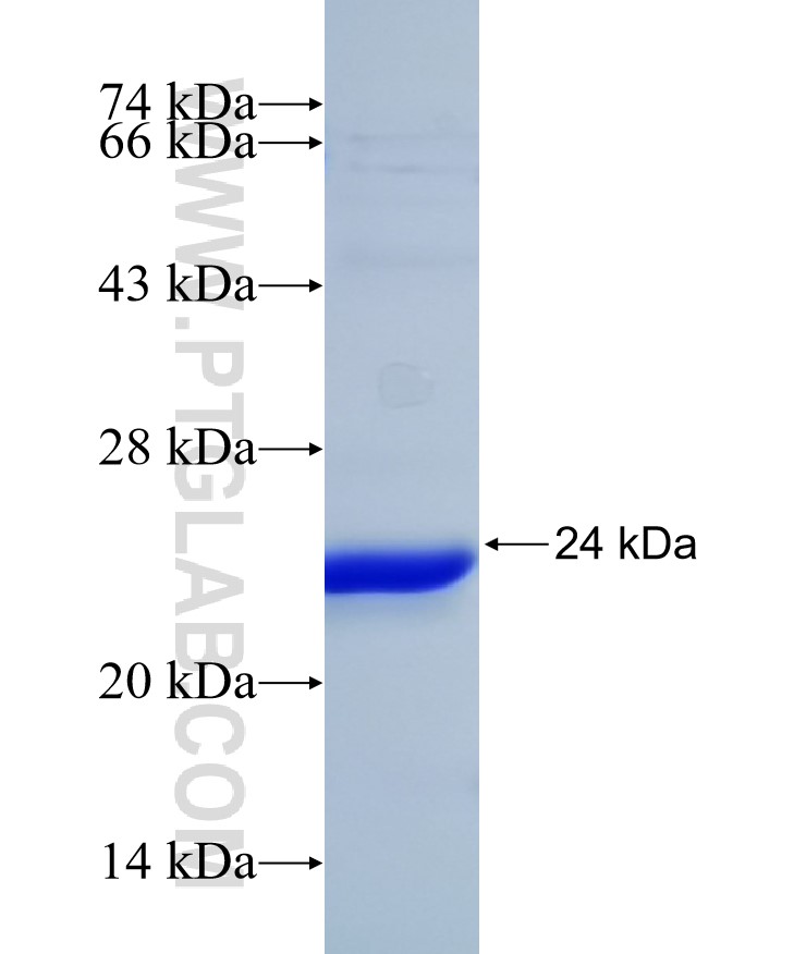 NFIB fusion protein Ag31991 SDS-PAGE