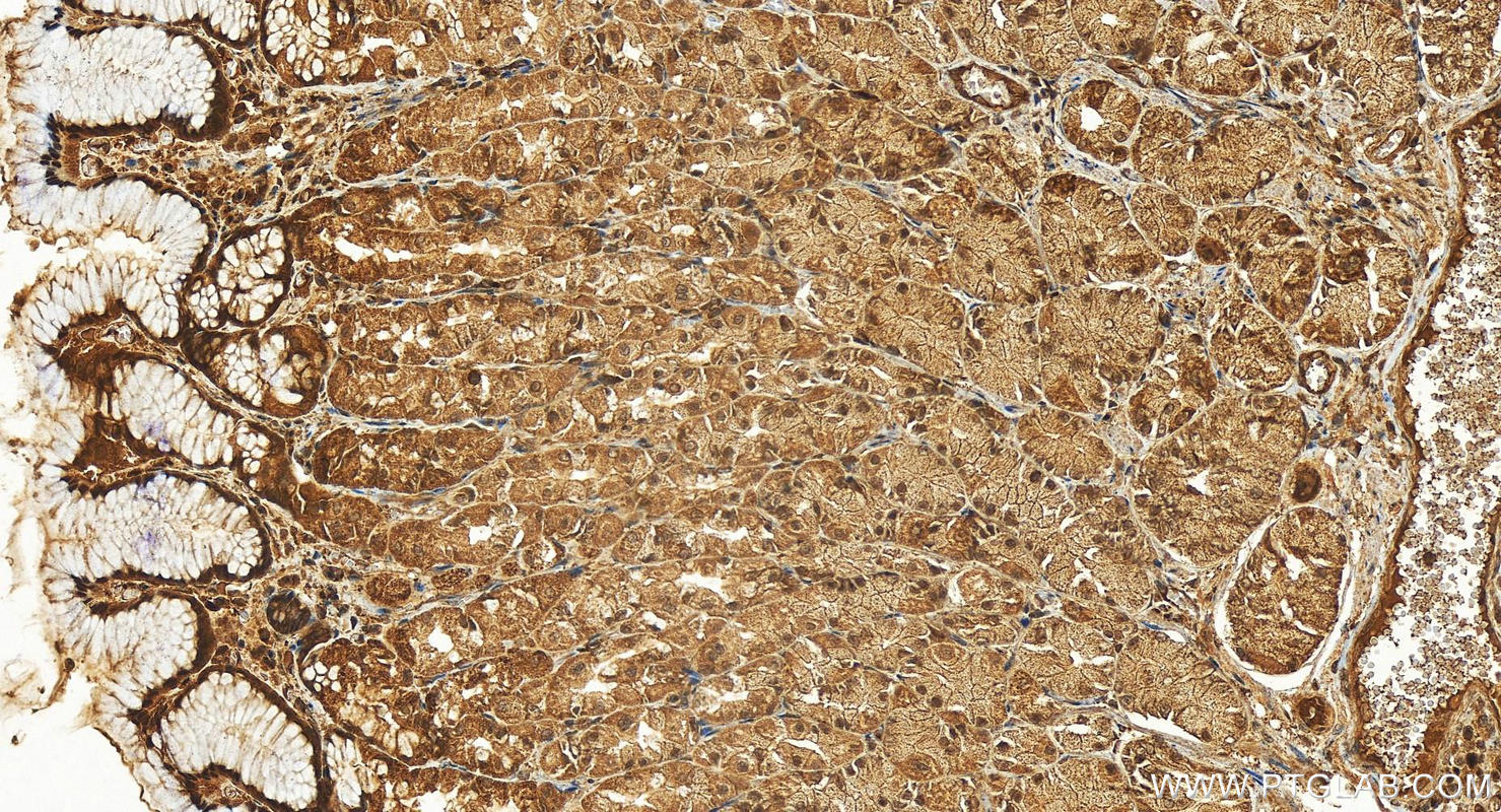 Immunohistochemistry (IHC) staining of human stomach tissue using NFKB1,p105,p50-Specific Polyclonal antibody (15506-1-AP)