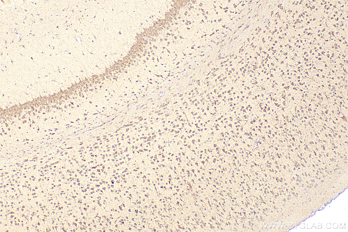 Immunohistochemistry (IHC) staining of mouse brain tissue using NFKB1,p105,p50-Specific Polyclonal antibody (15506-1-AP)