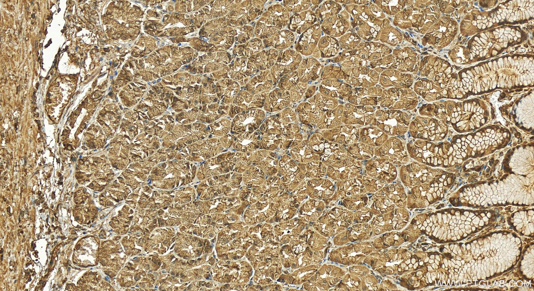 Immunohistochemistry (IHC) staining of human stomach tissue using NFKB1,p105,p50 Polyclonal antibody (14220-1-AP)