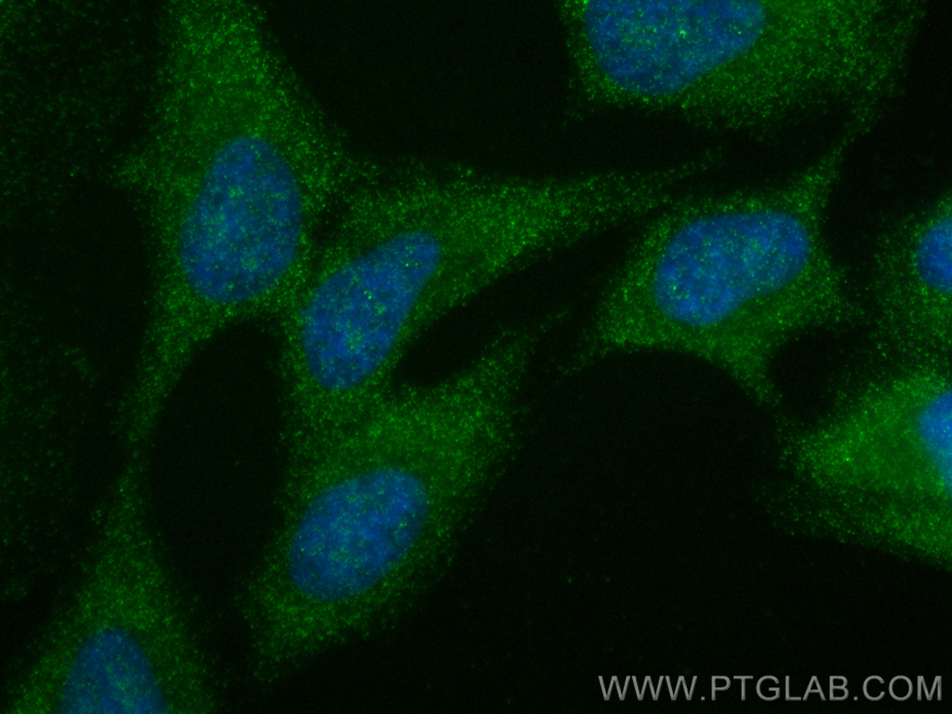 Immunofluorescence (IF) / fluorescent staining of HeLa cells using NFKB1,p105 Polyclonal antibody (23576-1-AP)