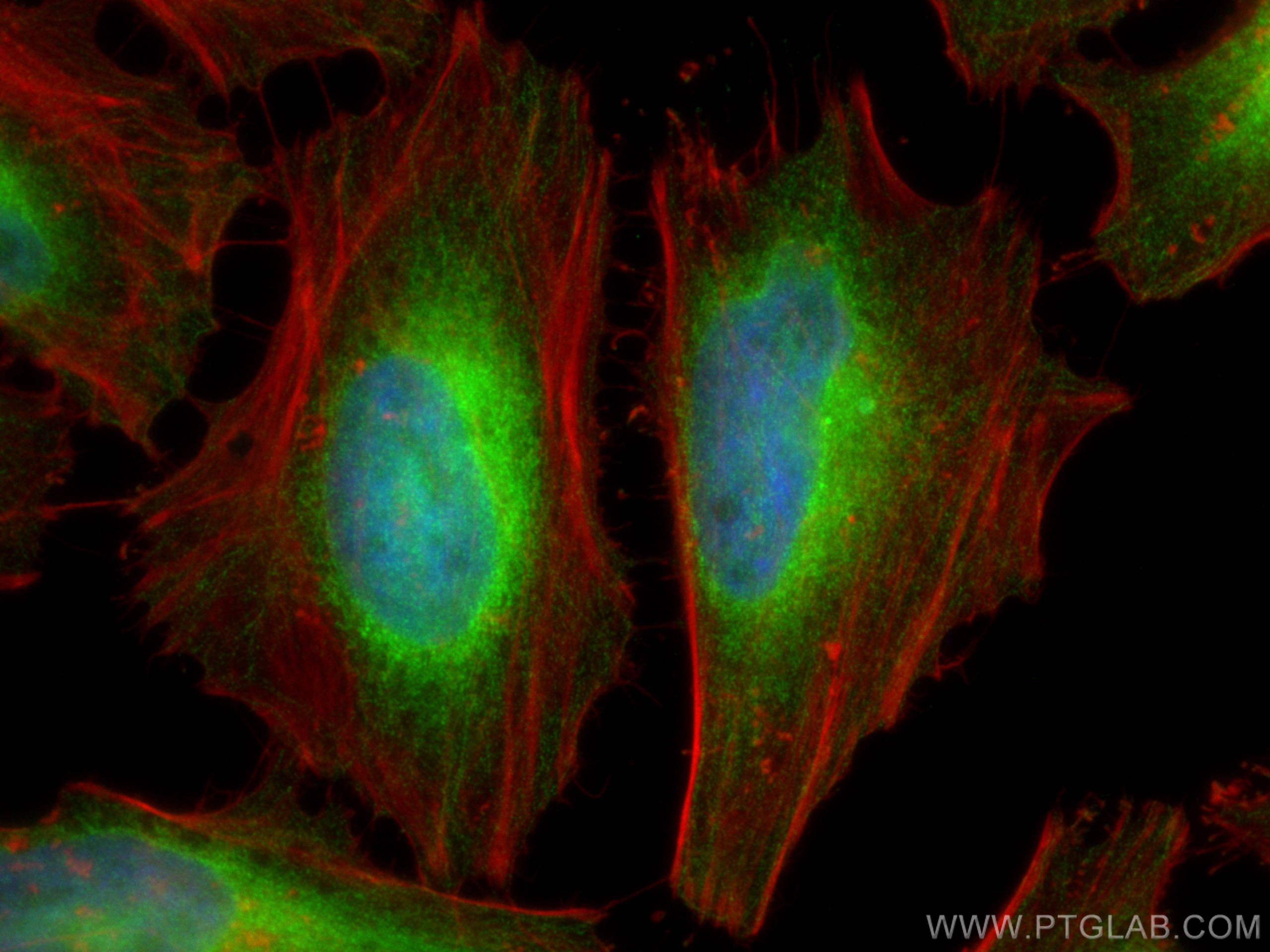 Immunofluorescence (IF) / fluorescent staining of HeLa cells using NFKB2,p52,p100-Specific Polyclonal antibody (15503-1-AP)