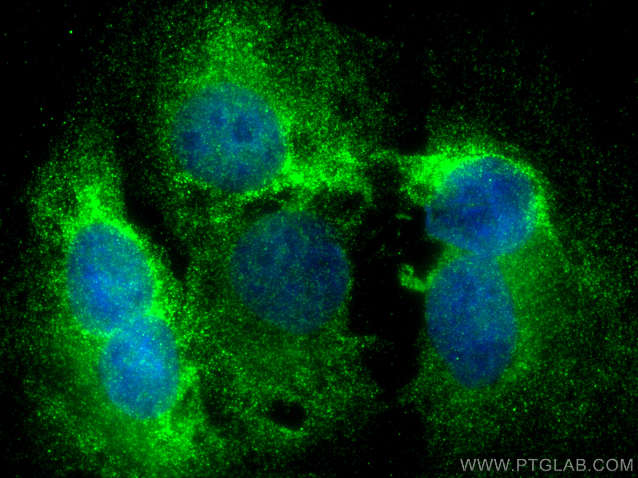 Immunofluorescence (IF) / fluorescent staining of U2OS cells using NFKB2,p100 Polyclonal antibody (10409-2-AP)