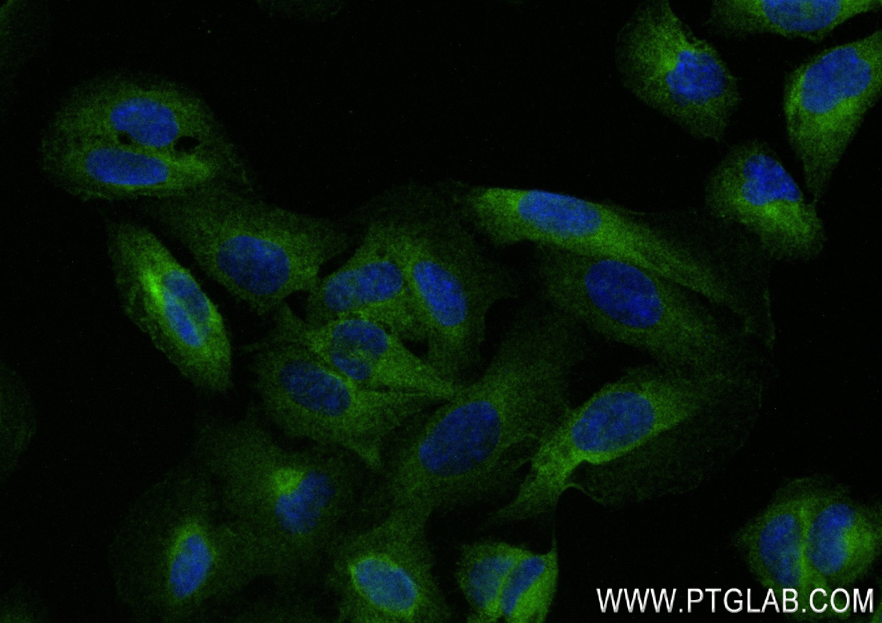 Immunofluorescence (IF) / fluorescent staining of U2OS cells using NFKB2,p100 Recombinant antibody (84022-6-RR)