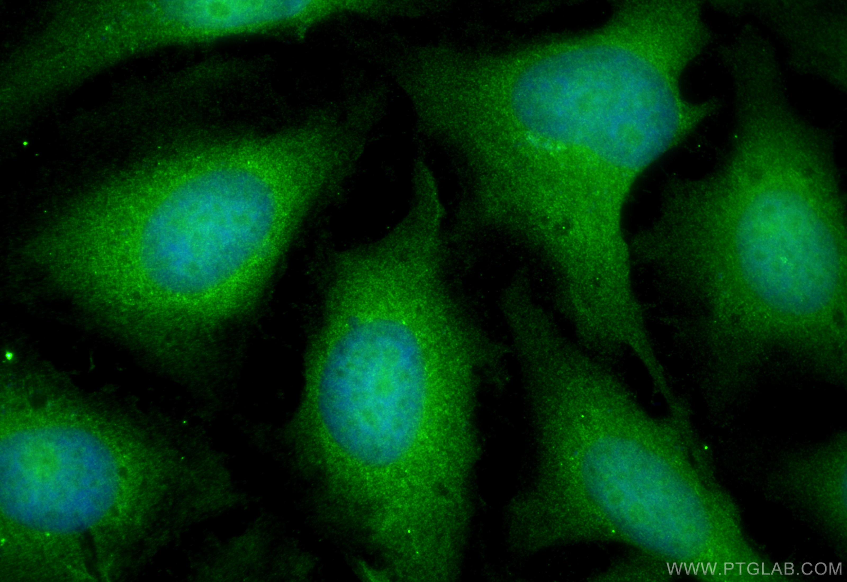 Immunofluorescence (IF) / fluorescent staining of HeLa cells using IkB Alpha Polyclonal antibody (10268-1-AP)