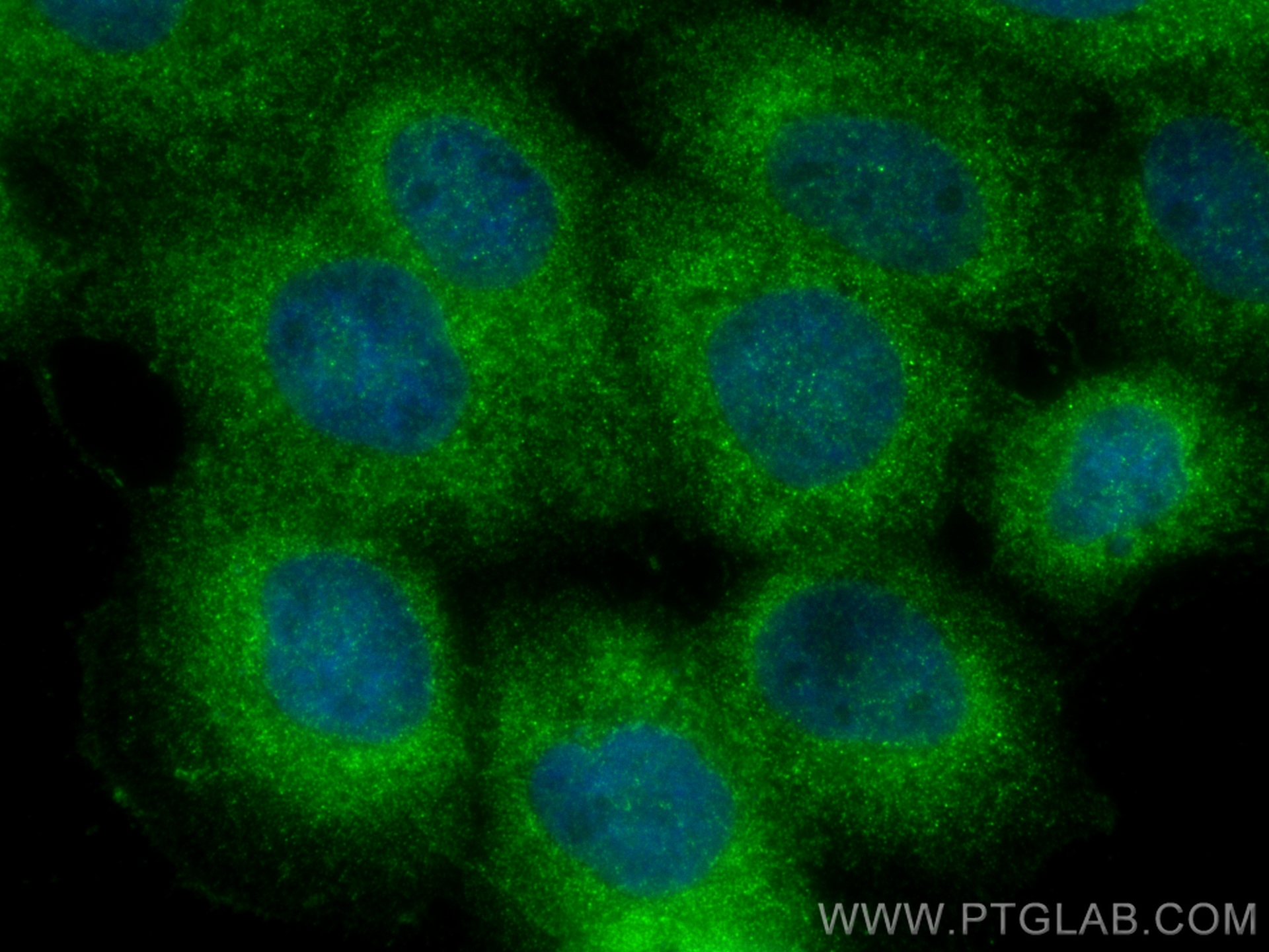 Immunofluorescence (IF) / fluorescent staining of A431 cells using IkB Alpha Polyclonal antibody (10268-1-AP)