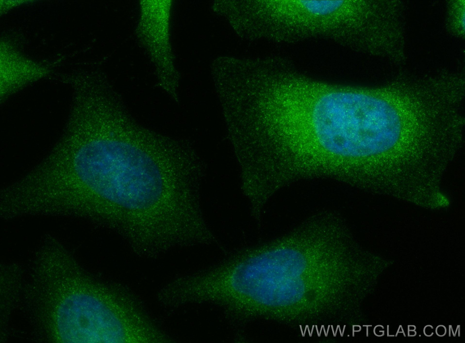 Immunofluorescence (IF) / fluorescent staining of HeLa cells using IkB Alpha Polyclonal antibody (10268-1-AP)