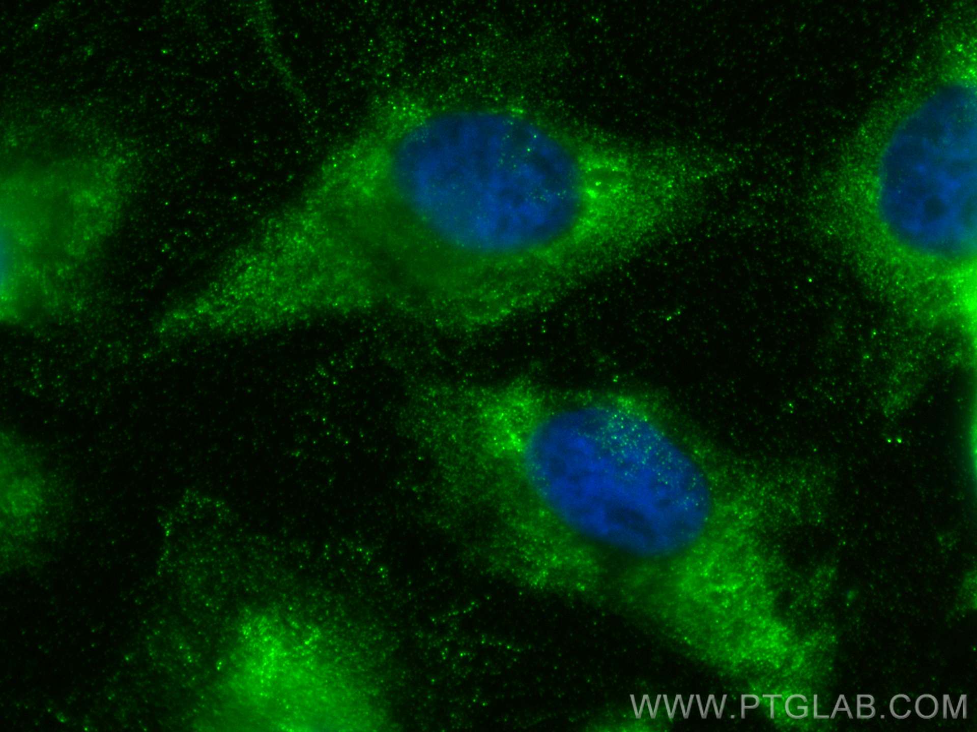 Immunofluorescence (IF) / fluorescent staining of HeLa cells using IkB Alpha Polyclonal antibody (18220-1-AP)