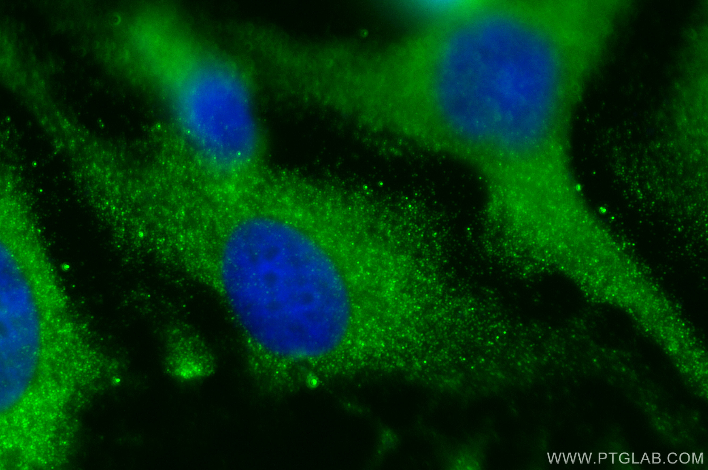 Immunofluorescence (IF) / fluorescent staining of HeLa cells using IkB Beta Polyclonal antibody (12660-1-AP)