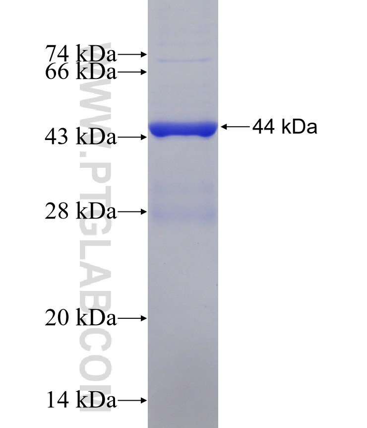 NFKBIZ fusion protein Ag30531 SDS-PAGE