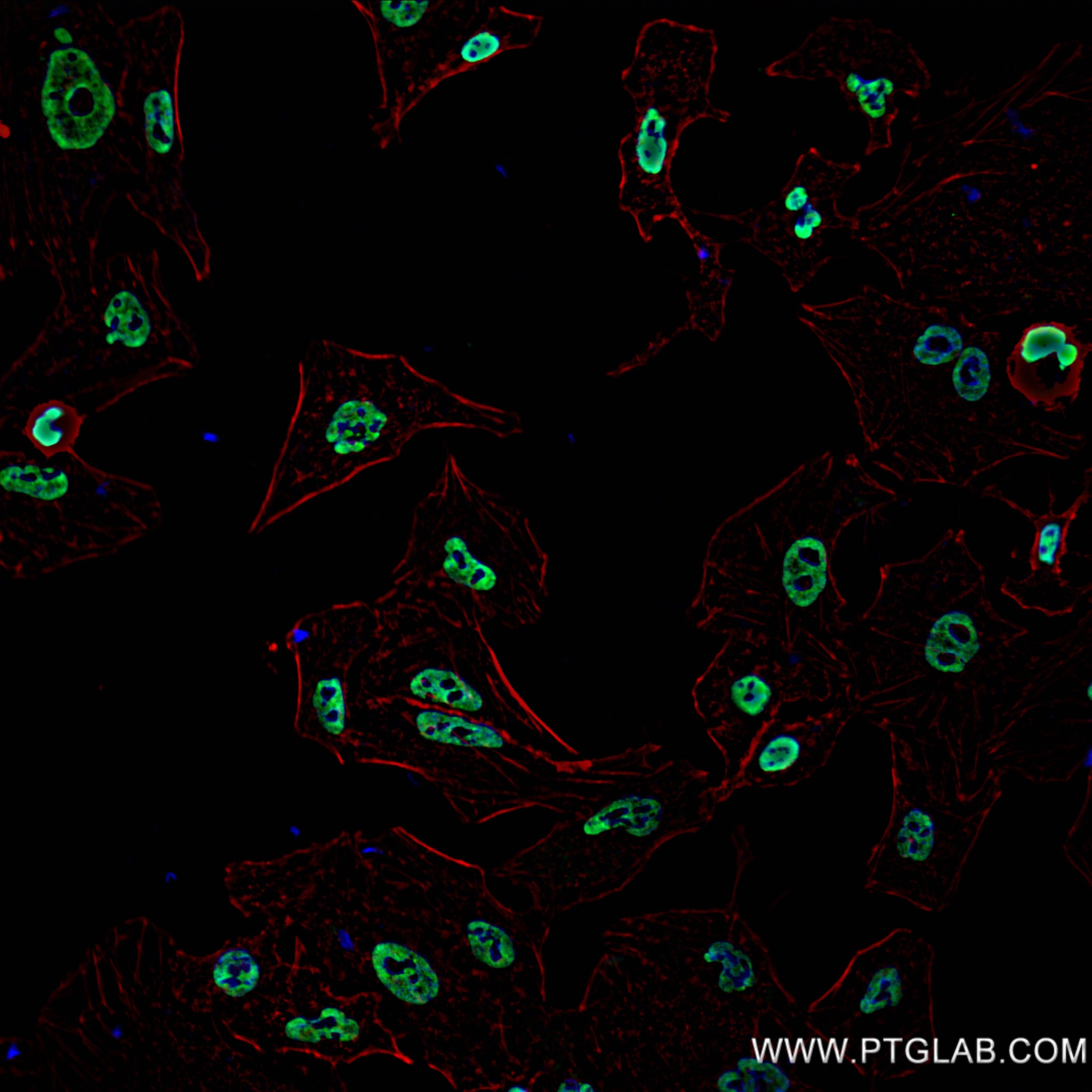 Immunofluorescence (IF) / fluorescent staining of HeLa cells using NFX1 Recombinant antibody (82924-1-RR)