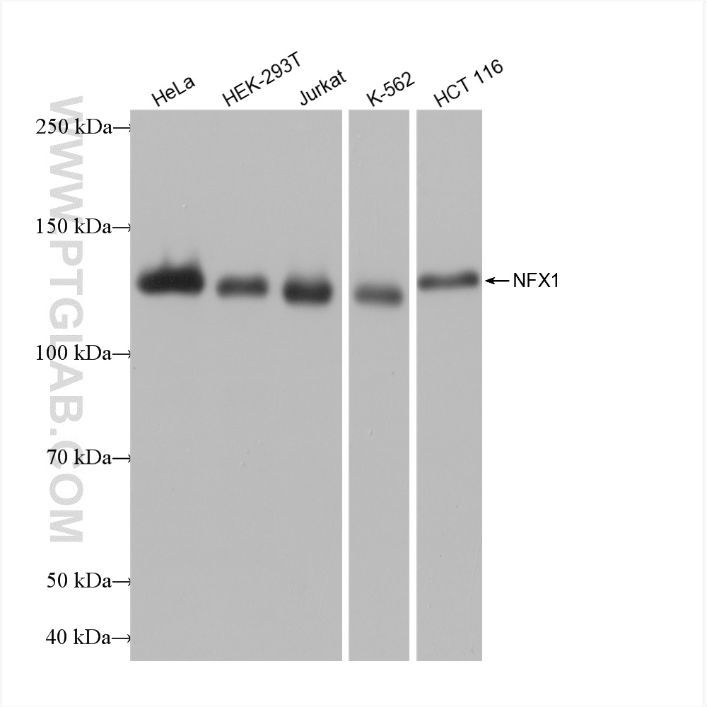 Western Blot (WB) analysis of various lysates using NFX1 Recombinant antibody (82924-2-RR)