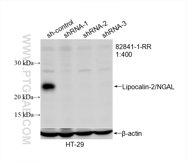 Western Blot (WB) analysis of HT-29 cells using NGAL Recombinant antibody (82841-1-RR)