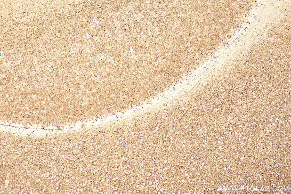 Immunohistochemistry (IHC) staining of mouse brain tissue using p75NTR Polyclonal antibody (55014-1-AP)