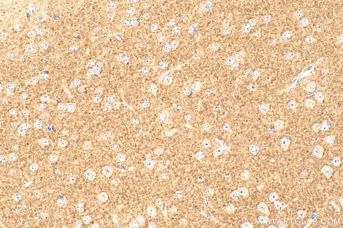 Immunohistochemistry (IHC) staining of mouse brain tissue using p75NTR Polyclonal antibody (55014-1-AP)