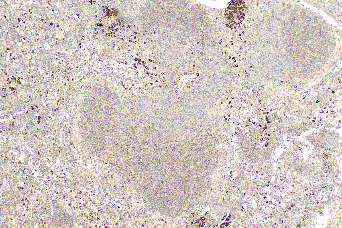 Immunohistochemistry (IHC) staining of mouse spleen tissue using p75NTR Polyclonal antibody (55014-1-AP)