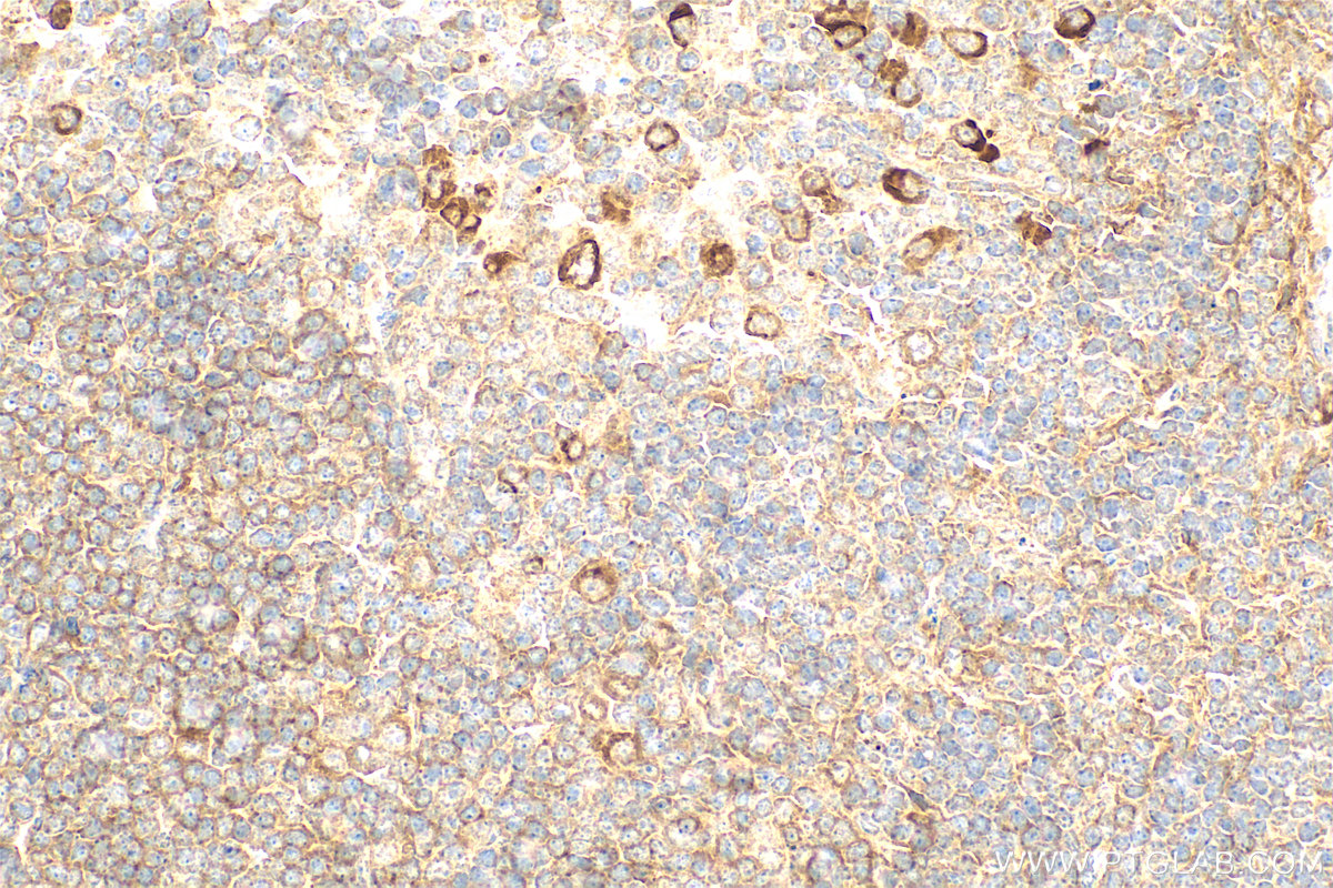 Immunohistochemistry (IHC) staining of mouse spleen tissue using p75NTR Polyclonal antibody (55014-1-AP)