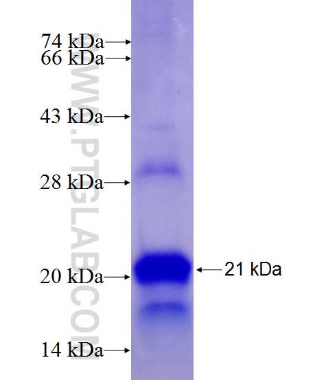 NGRH2 fusion protein Ag27274 SDS-PAGE