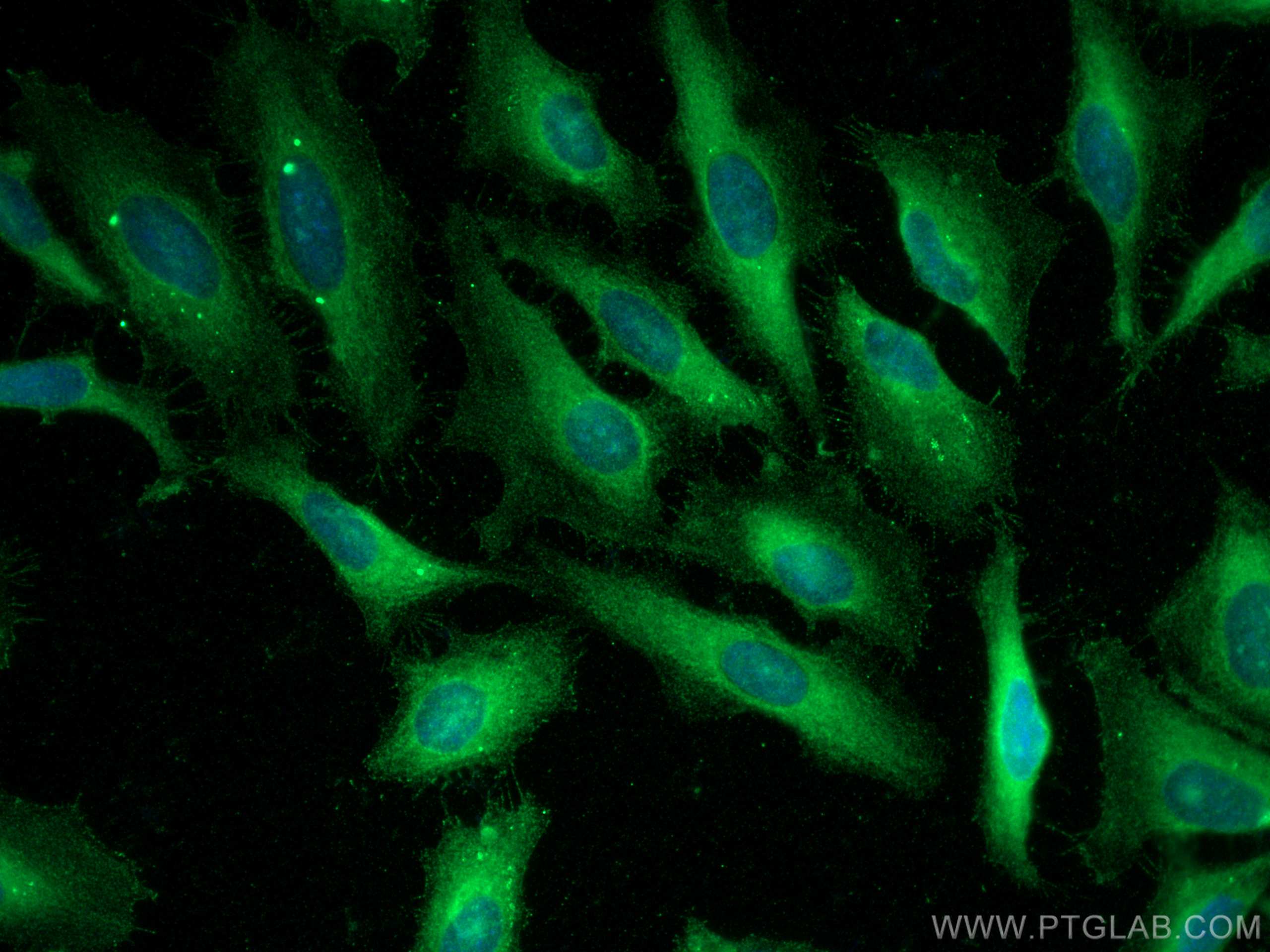 Immunofluorescence (IF) / fluorescent staining of HeLa cells using NHE1 Polyclonal antibody (29761-1-AP)