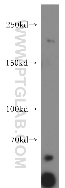 Western Blot (WB) analysis of mouse heart tissue using Nidogen 2 Polyclonal antibody (19076-1-AP)