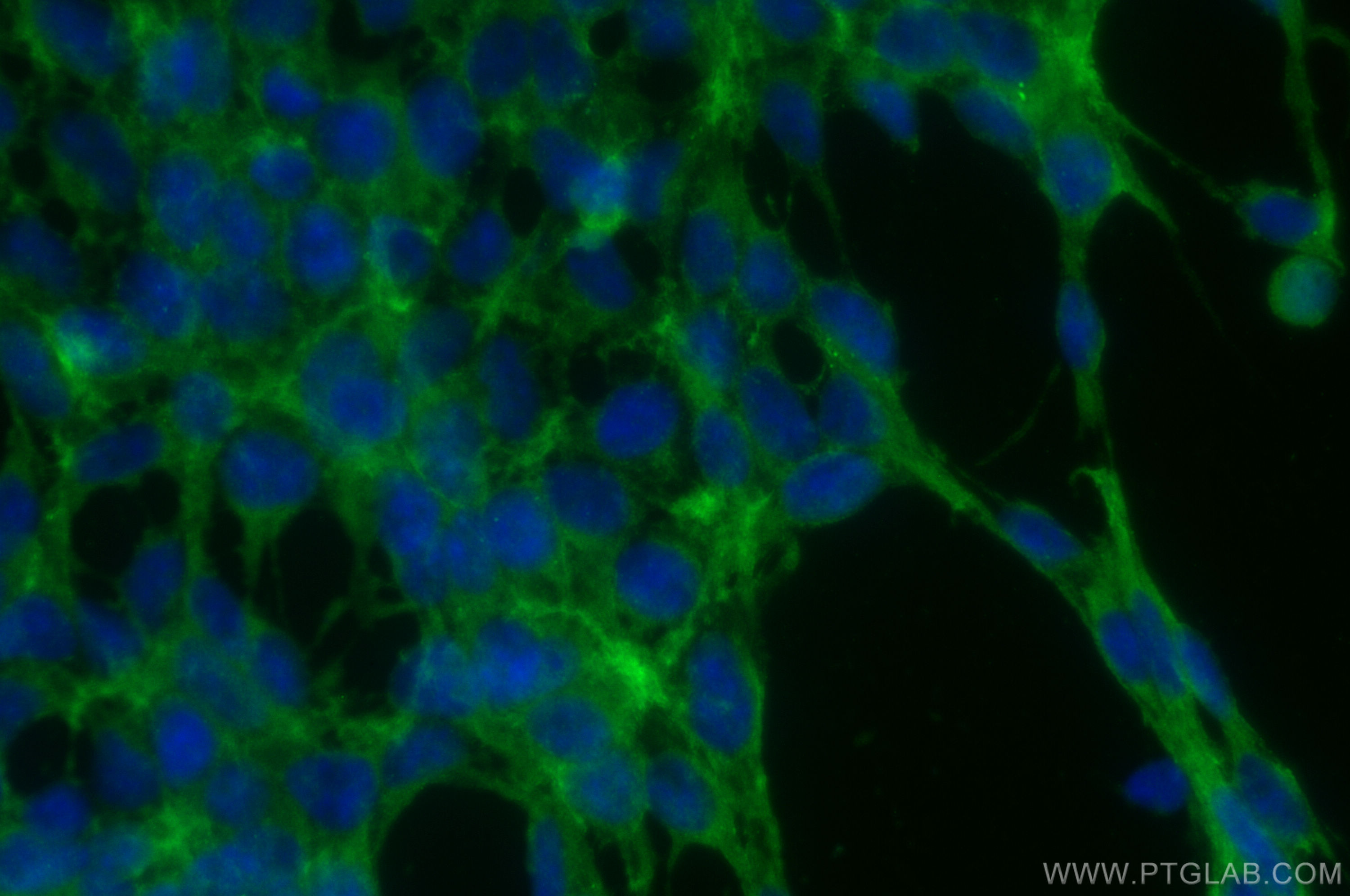 Immunofluorescence (IF) / fluorescent staining of HEK-293 cells using NIPSNAP3A Polyclonal antibody (10751-1-AP)