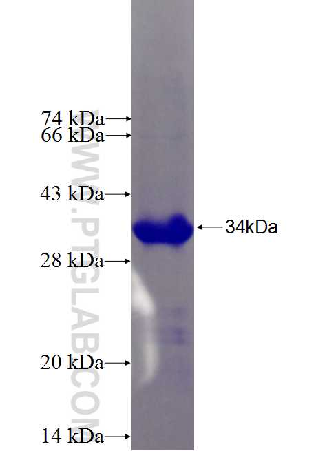 NIPSNAP3A fusion protein Ag27112 SDS-PAGE