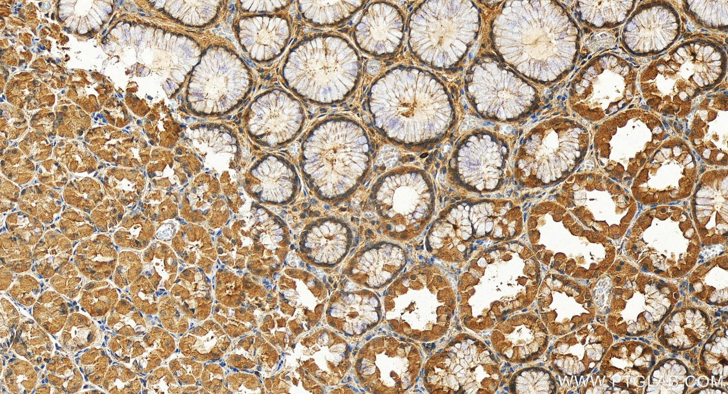 Immunohistochemistry (IHC) staining of human stomach tissue using NISCH Polyclonal antibody (13813-1-AP)