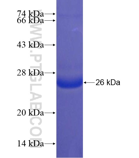 NKIRAS2 fusion protein Ag20532 SDS-PAGE