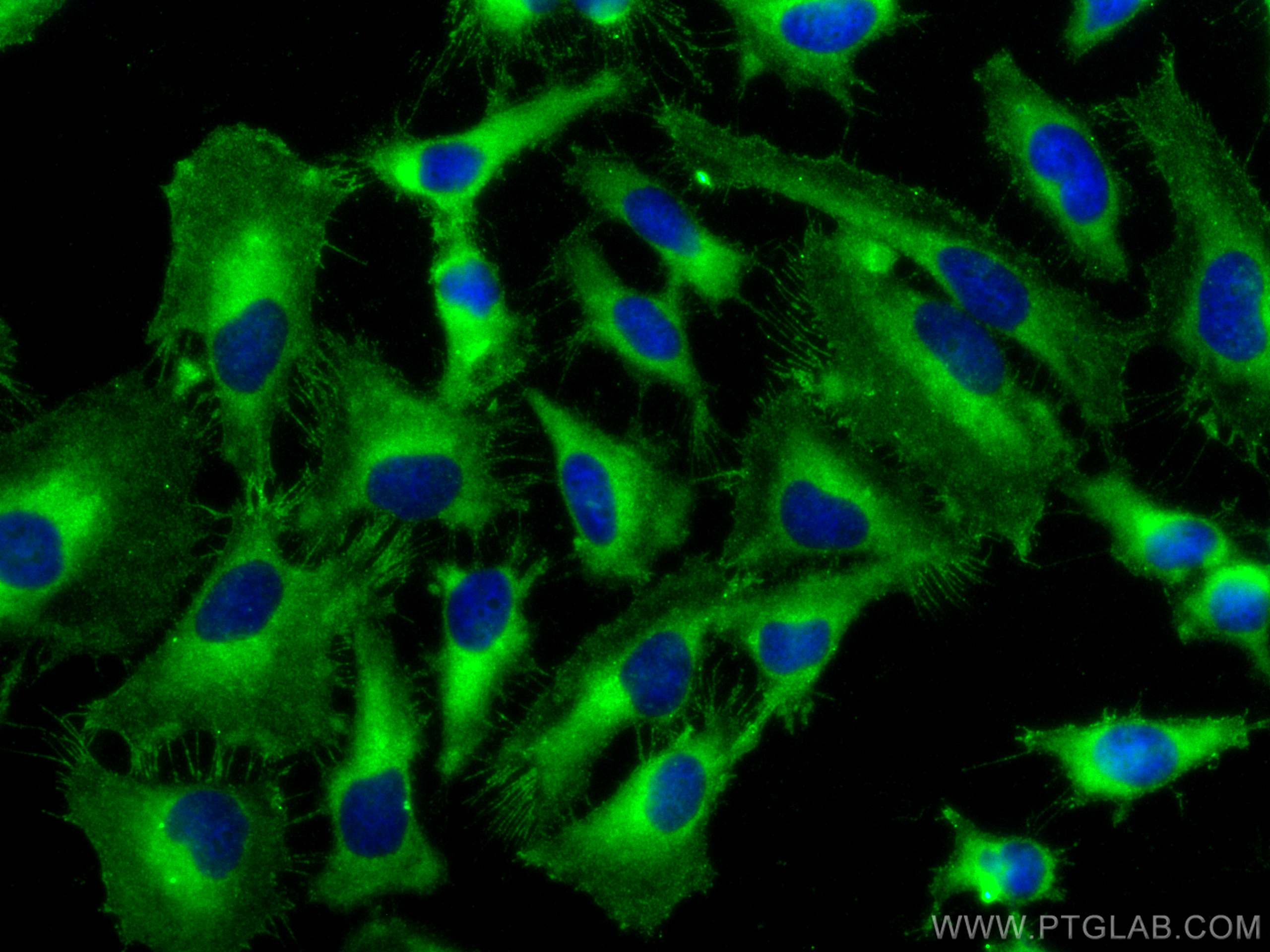 Immunofluorescence (IF) / fluorescent staining of HeLa cells using NKTR Polyclonal antibody (19978-1-AP)