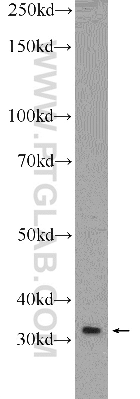 Western Blot (WB) analysis of SH-SY5Y cells using NKX1-2 Polyclonal antibody (55484-1-AP)