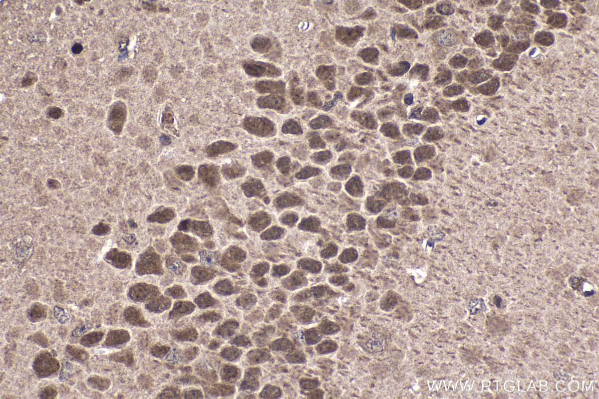 Immunohistochemistry (IHC) staining of mouse brain tissue using NKX2-2 Polyclonal antibody (13013-1-AP)