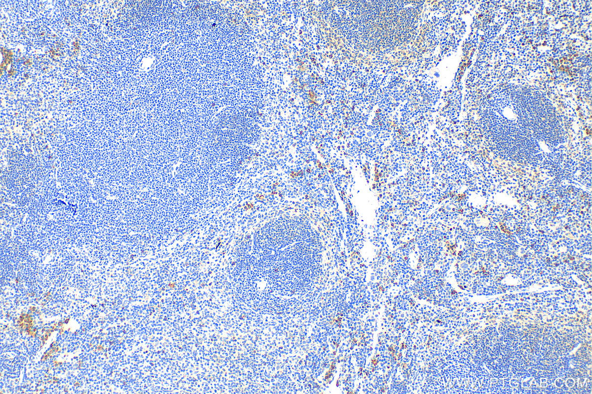 Immunohistochemistry (IHC) staining of mouse spleen tissue using NKp46/NCR1 Polyclonal antibody (31984-1-AP)