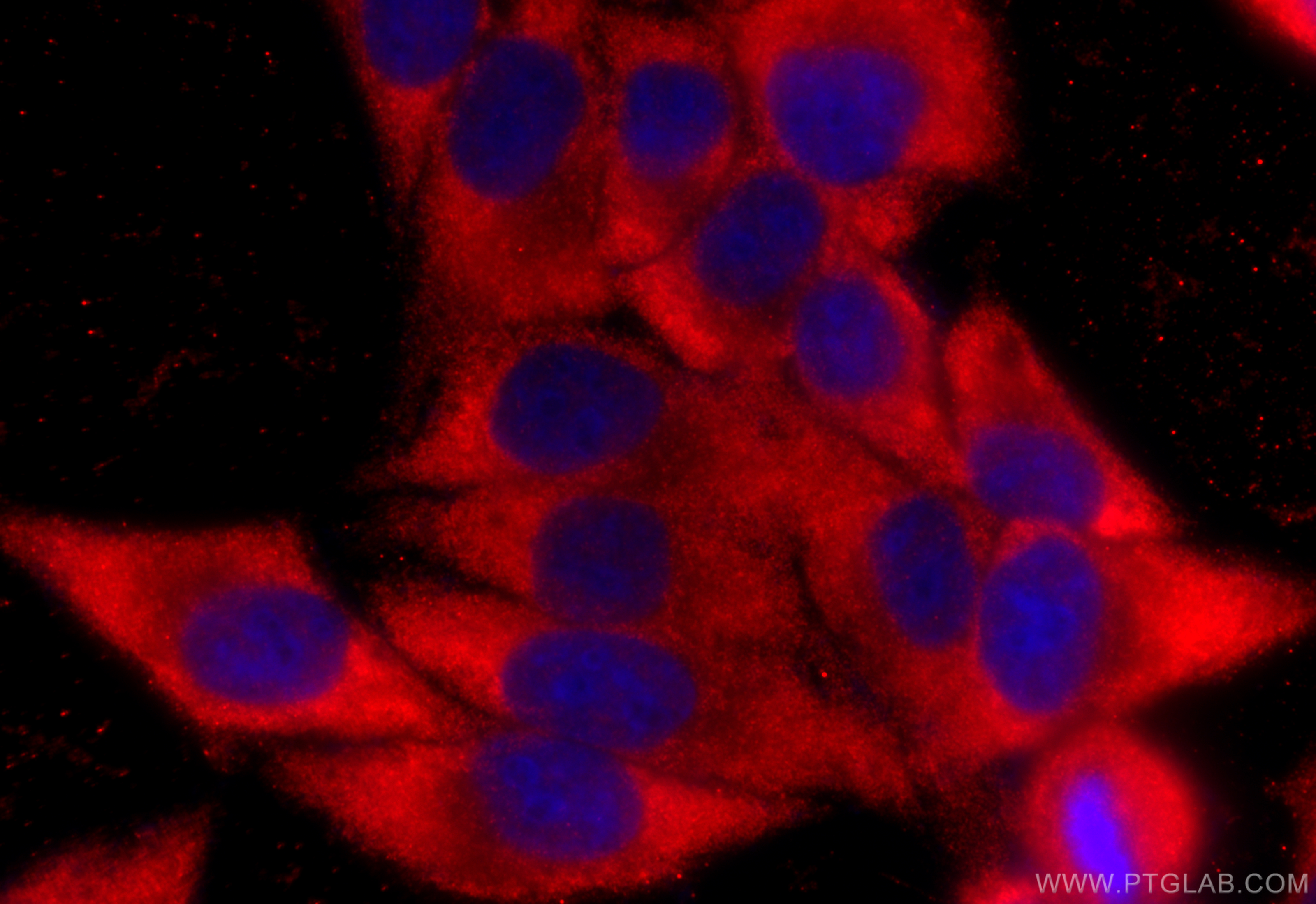 Immunofluorescence (IF) / fluorescent staining of HepG2 cells using NLRP3 Polyclonal antibody (27458-1-AP)