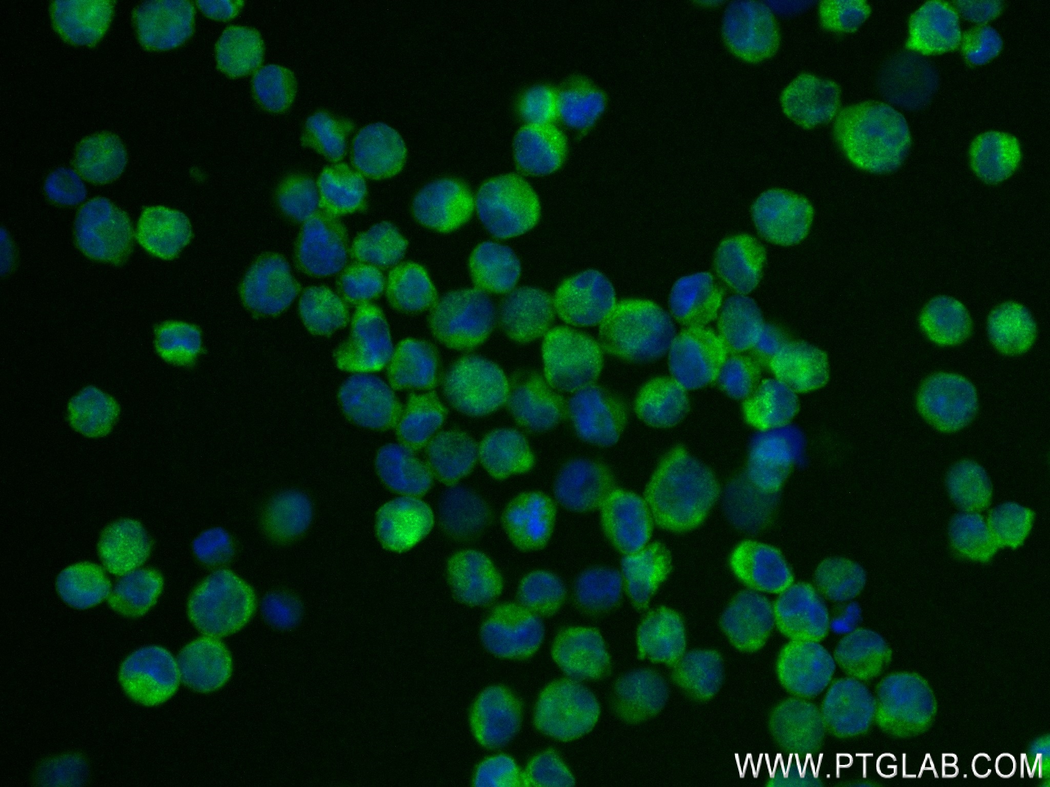 Immunofluorescence (IF) / fluorescent staining of K-562 cells using NLRP7 Recombinant antibody (83996-4-RR)