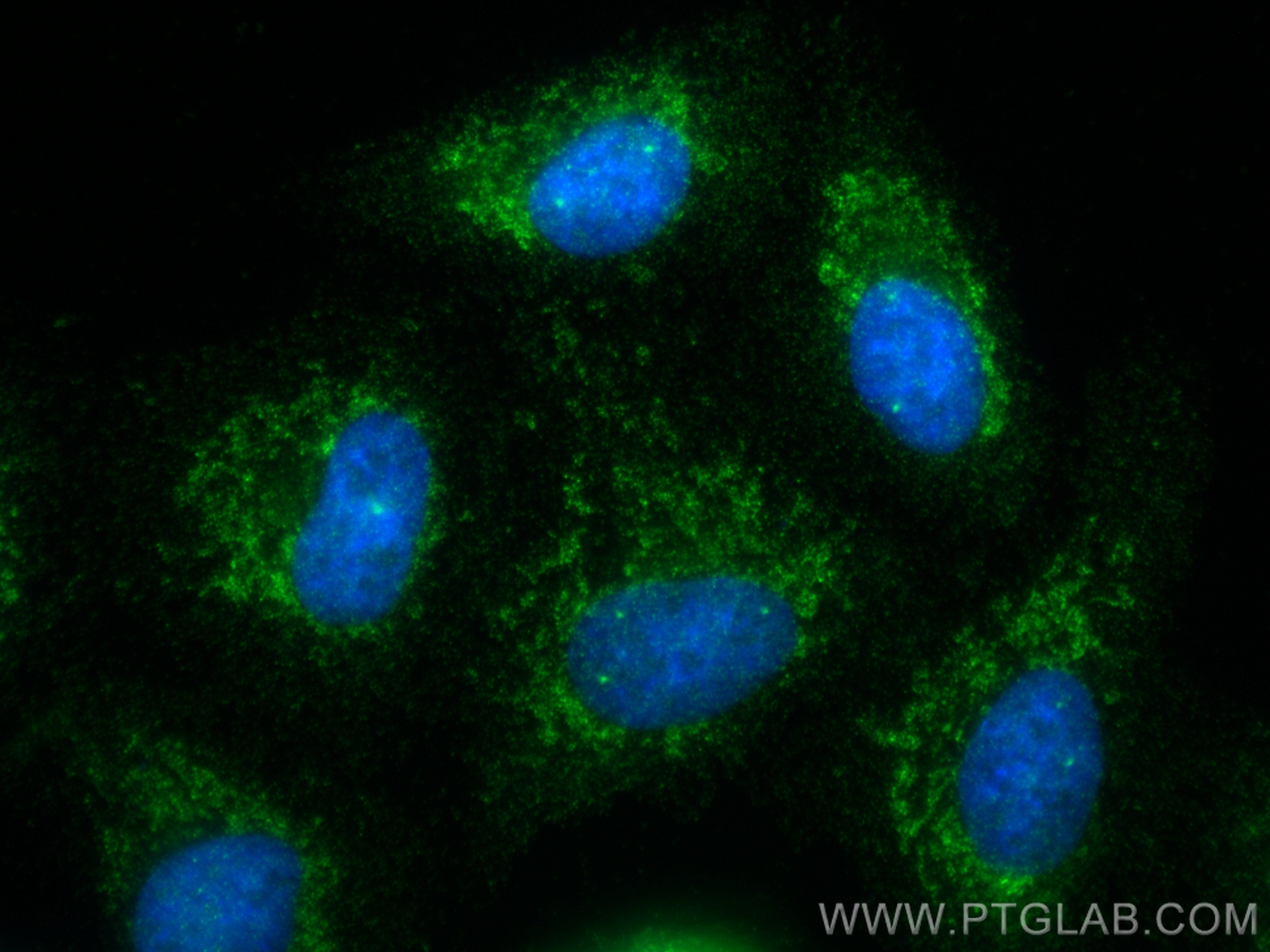 Immunofluorescence (IF) / fluorescent staining of A549 cells using NLRX1 Polyclonal antibody (17215-1-AP)