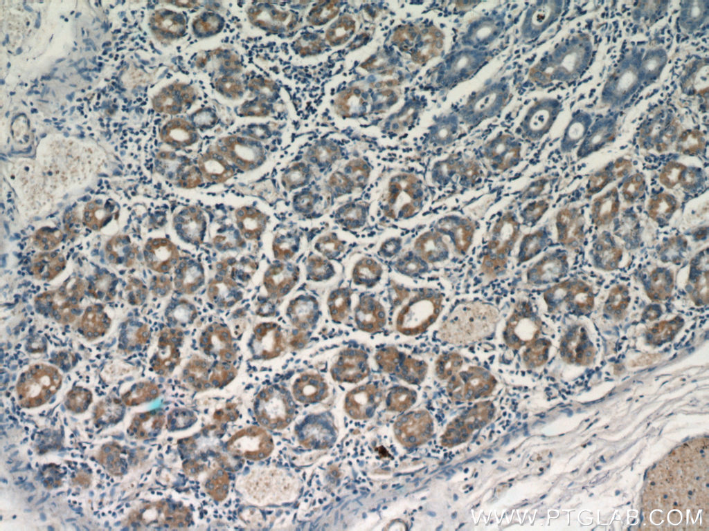 Immunohistochemistry (IHC) staining of human stomach tissue using Neuromedin B Polyclonal antibody (22294-1-AP)