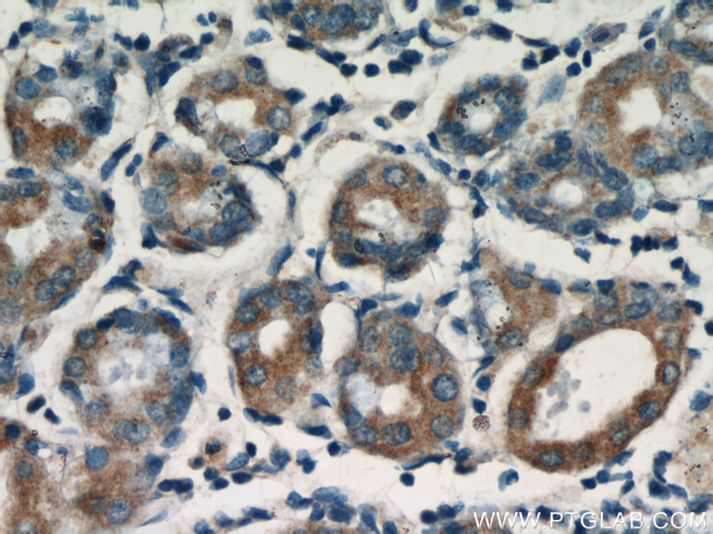 Immunohistochemistry (IHC) staining of human stomach tissue using Neuromedin B Polyclonal antibody (22294-1-AP)