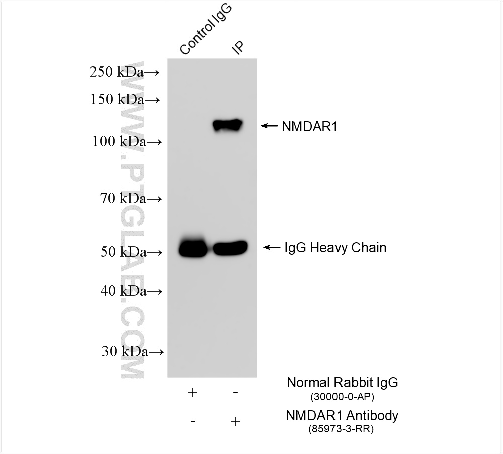 Immunoprecipitation (IP) experiment of mouse brain tissue using NMDAR1/GRIN1 Recombinant antibody (85973-3-RR)