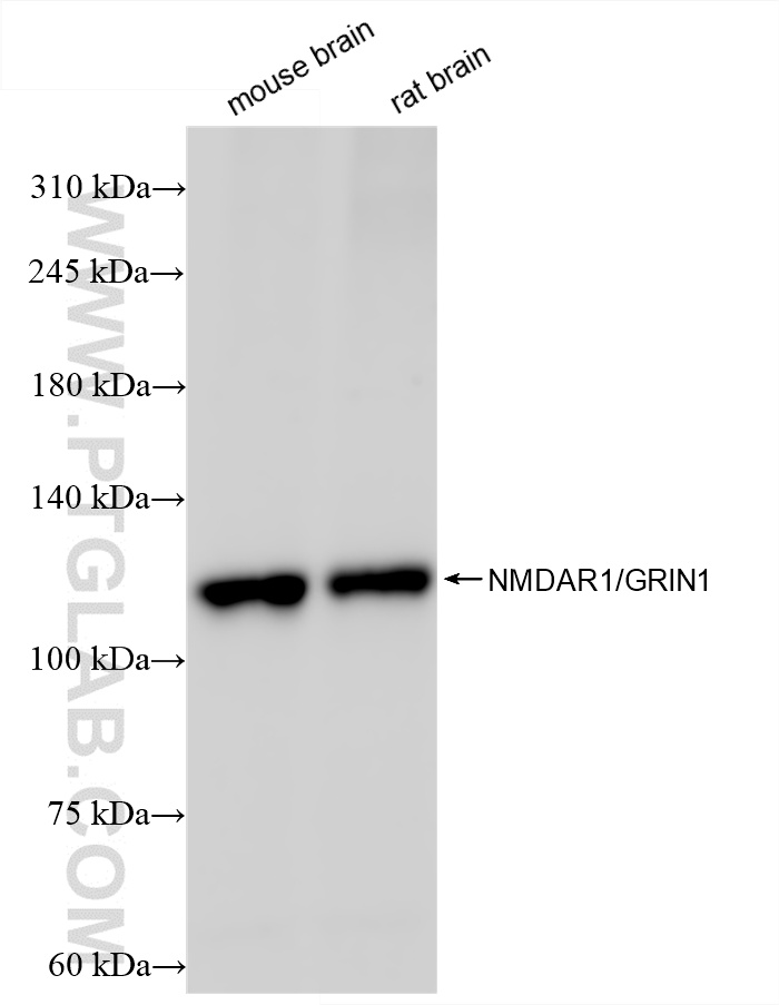 Western Blot (WB) analysis of various lysates using NMDAR1/GRIN1 Recombinant antibody (85973-3-RR)