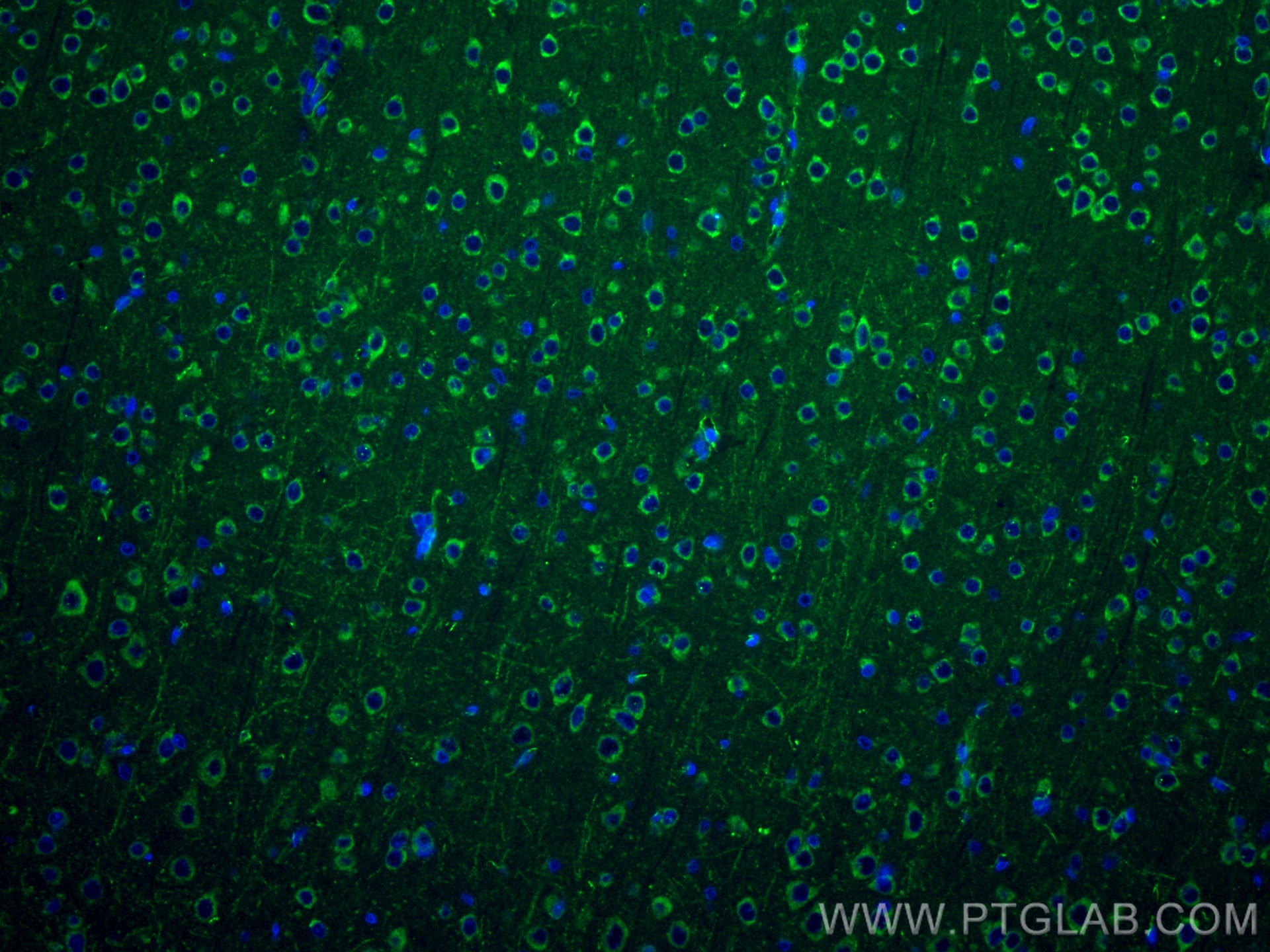 Immunofluorescence (IF) / fluorescent staining of rat brain tissue using NMDAR2A/GRIN2A Recombinant antibody (83465-2-RR)