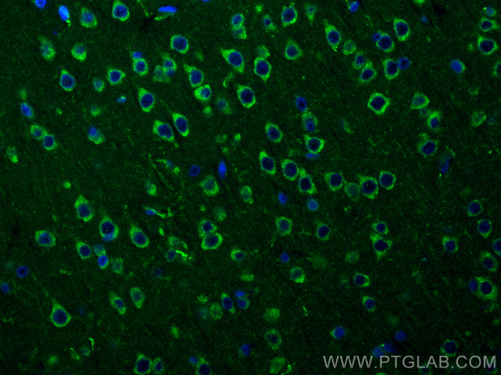 Immunofluorescence (IF) / fluorescent staining of rat brain tissue using NMDAR2A/GRIN2A Recombinant antibody (83465-2-RR)