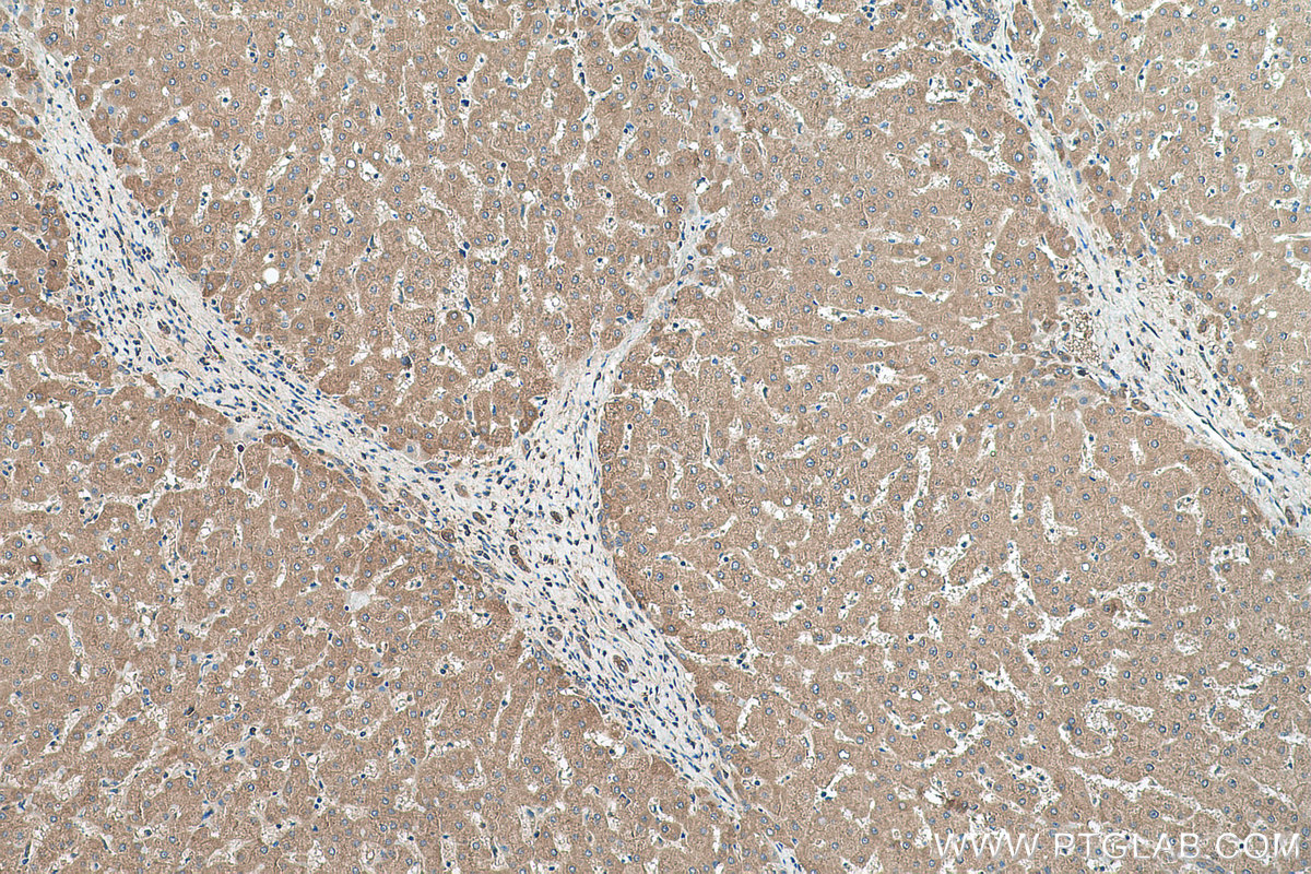 Immunohistochemistry (IHC) staining of human liver tissue using NME1 Polyclonal antibody (11086-2-AP)