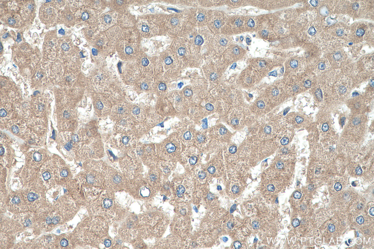 Immunohistochemistry (IHC) staining of human liver tissue using NME1 Polyclonal antibody (11086-2-AP)