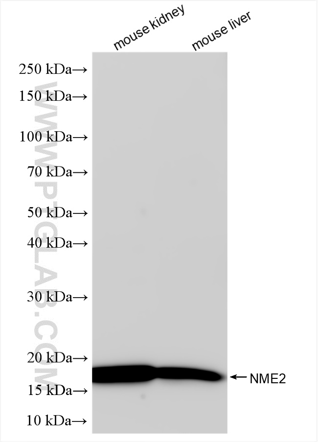 Western Blot (WB) analysis of various lysates using NME2 Recombinant antibody (85074-2-RR)