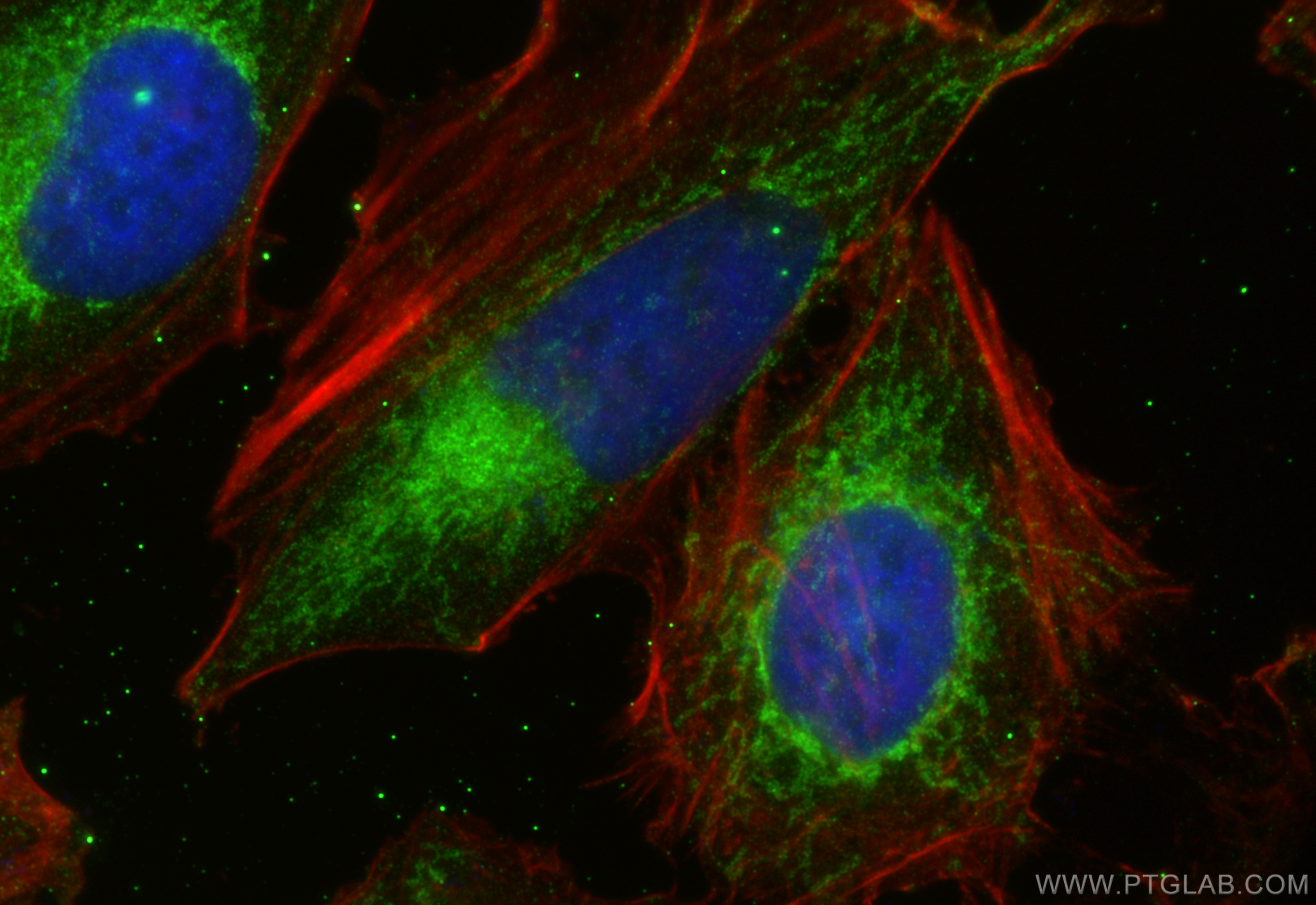 Immunofluorescence (IF) / fluorescent staining of HeLa cells using NME3 Polyclonal antibody (15136-1-AP)