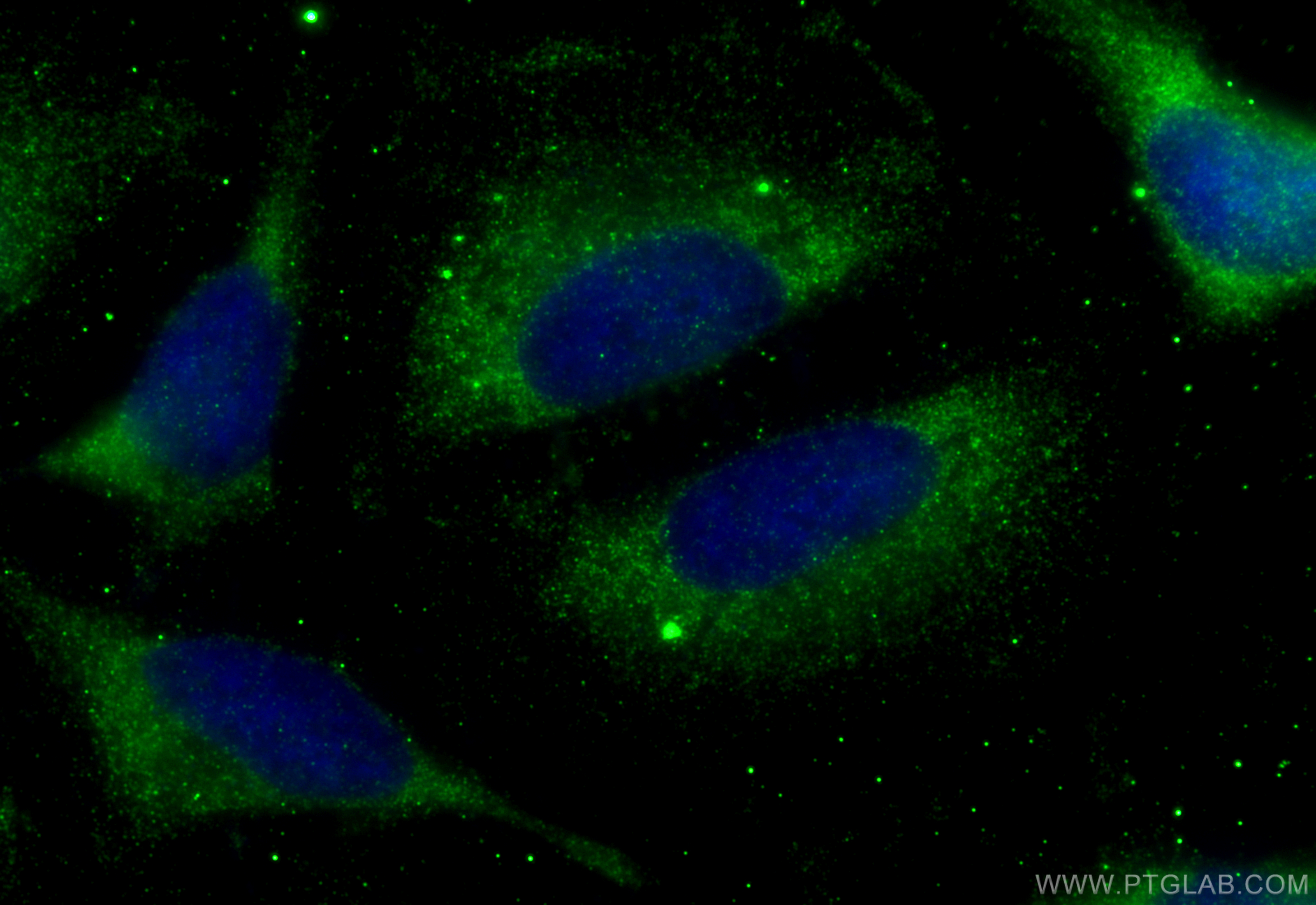 Immunofluorescence (IF) / fluorescent staining of HeLa cells using NME3 Polyclonal antibody (15136-1-AP)