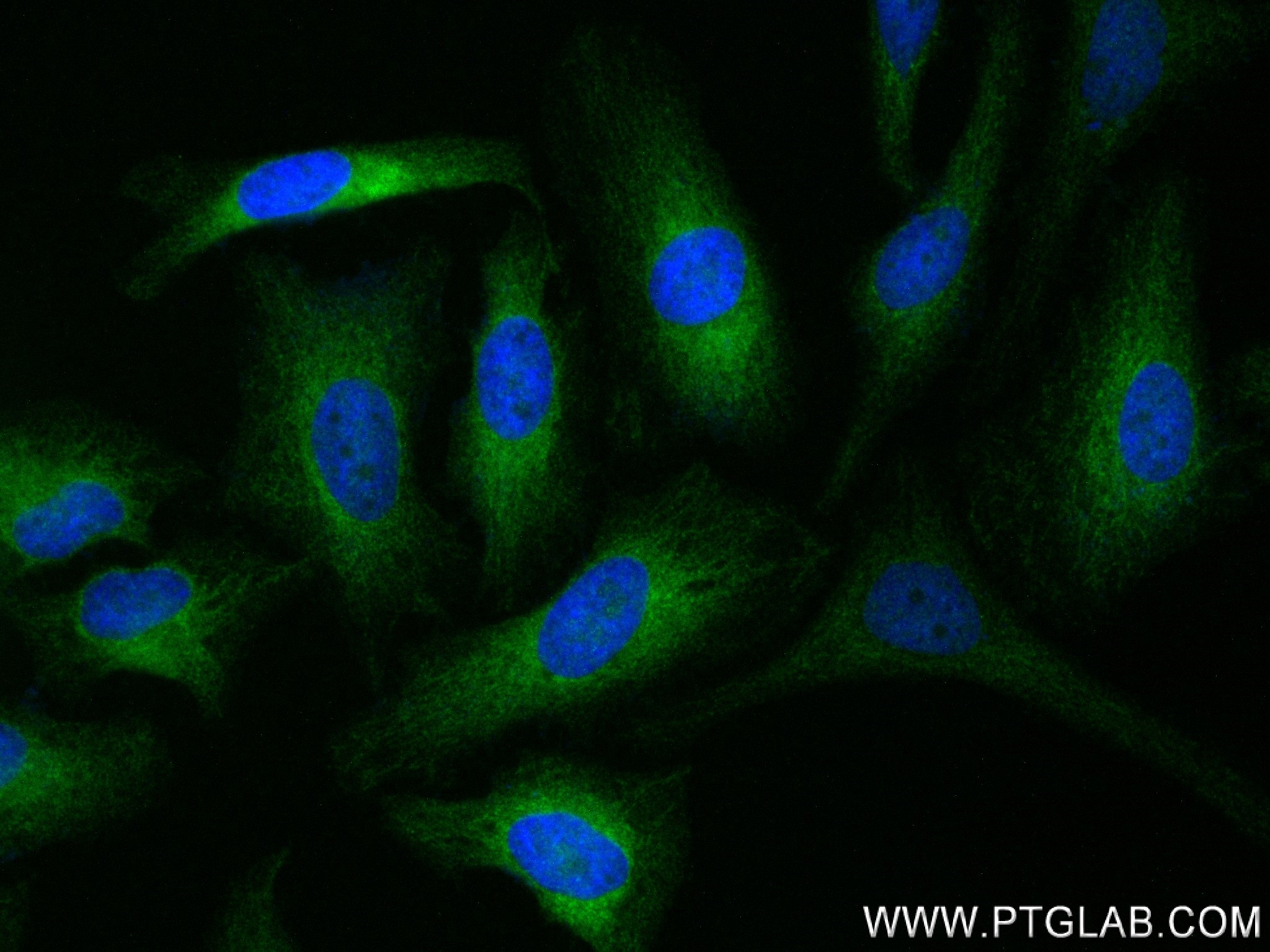 Immunofluorescence (IF) / fluorescent staining of HeLa cells using NME3 Recombinant antibody (84278-5-RR)