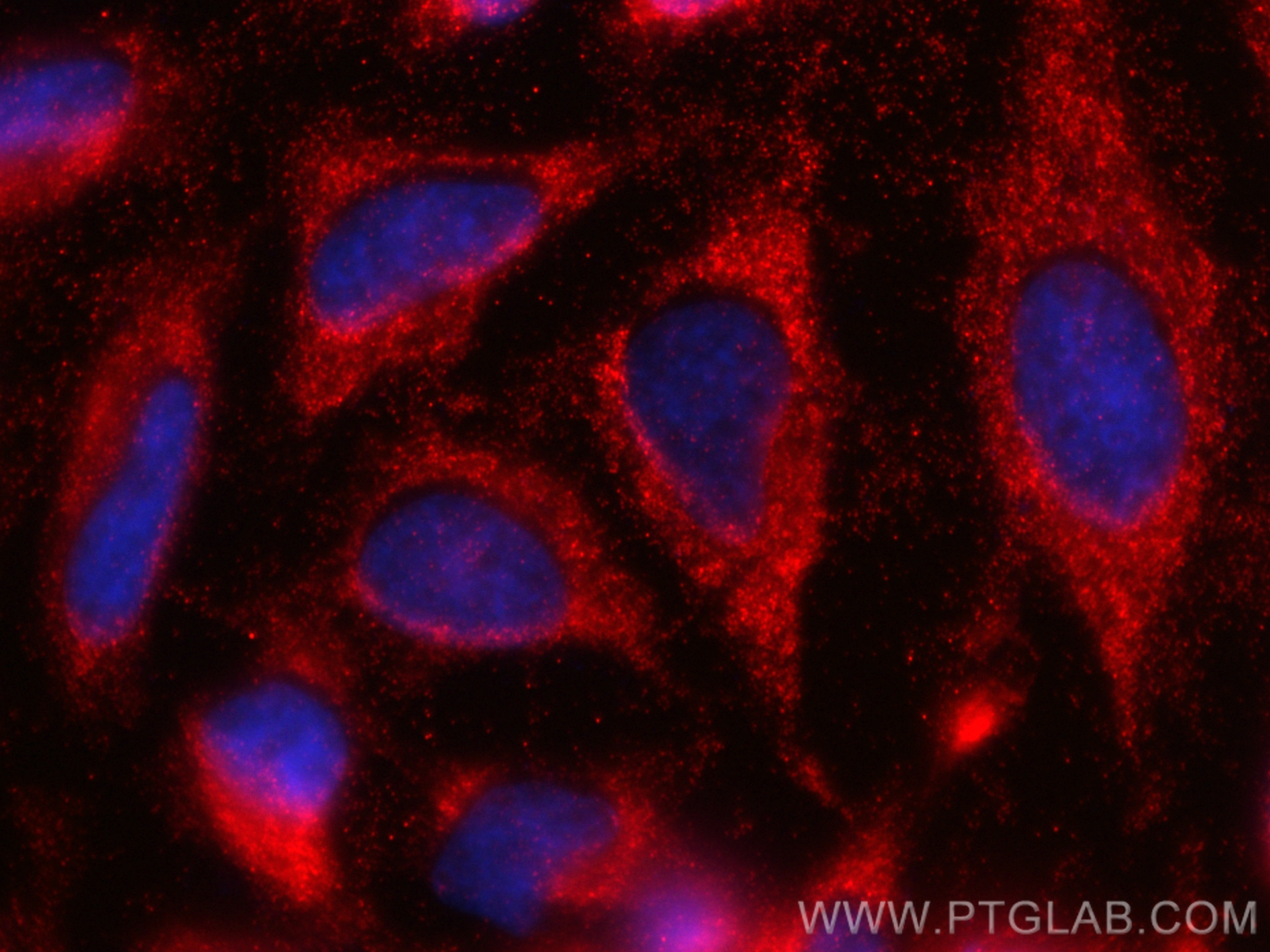 Immunofluorescence (IF) / fluorescent staining of HeLa cells using NME3 Recombinant antibody (84278-5-RR)