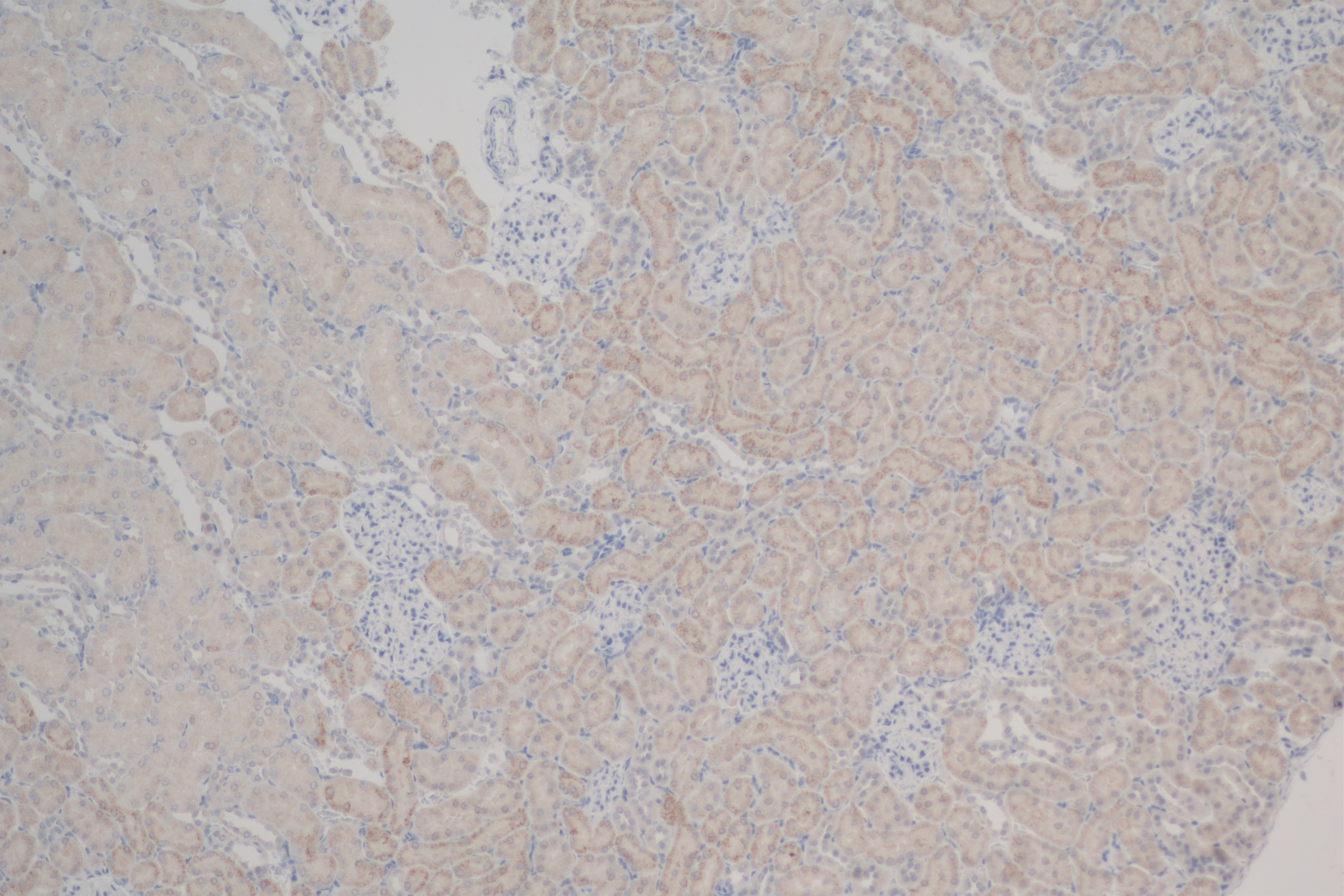 Immunohistochemistry (IHC) staining of rat kidney tissue using NME3 Recombinant antibody (84278-5-RR)